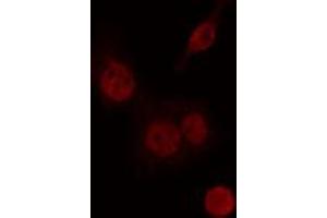 ABIN6274235 staining Hela cells by IF/ICC. (CIITA Antikörper  (Internal Region))