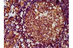 IHC image of ABIN7143386 diluted at 1:500 and staining in paraffin-embedded human lymph node tissue performed on a Leica BondTM system. (ADGRE2 Antikörper  (AA 151-323))