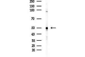Western blot analysis of lysates from Mouse brain, using GAL Antibody at 1/1000 dilution.
