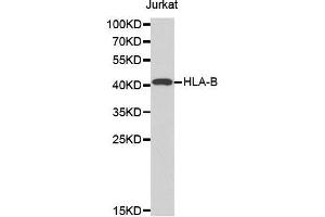 Western blot analysis of extracts of Jurkat cell line, using HLA-B antibody. (HLA-B Antikörper  (AA 1-100))