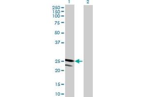 Western Blot analysis of TMED4 expression in transfected 293T cell line by TMED4 MaxPab polyclonal antibody.