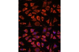 Immunofluorescence analysis of L929 cells using PI4KB antibody (ABIN7269287) at dilution of 1:100. (PI4KB Antikörper  (AA 560-801))