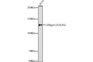 Western blot analysis of extracts of  cells, using Collagen I/COL1 antibody (ABIN6134502, ABIN6138839, ABIN6138840 and ABIN6221469) at 1:1000 dilution. (COL1A2 Antikörper  (AA 500-600))