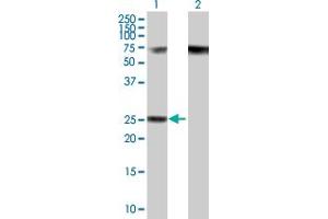Western Blot analysis of RPP40 expression in transfected 293T cell line by RPP40 MaxPab polyclonal antibody. (RPP40 Antikörper  (AA 1-244))