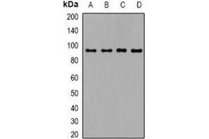 Western Blotting (WB) image for anti-Transforming Growth Factor, beta Receptor III (TGFBR3) (C-Term) antibody (ABIN7304586)
