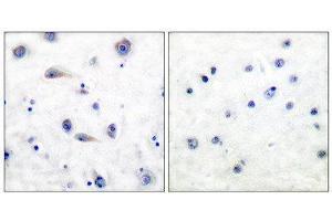Immunohistochemistry (IHC) image for anti-Neurotrophic Tyrosine Kinase, Receptor, Type 2 (NTRK2) (pTyr515) antibody (ABIN1847226) (TRKB Antikörper  (pTyr515))