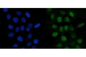 IF analysis of Cyclin A2 using anti-Cyclin A2 antibody (ABIN3043481).