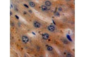 Used in DAB staining on fromalin fixed paraffin-embedded Liver tissue (alpha 2 Antiplasmin Antikörper  (AA 340-491))