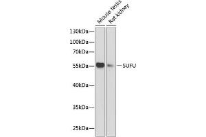 Western blot analysis of extracts of various cell lines, using SUFU antibody (ABIN6133029, ABIN6148692, ABIN6148694 and ABIN6217424) at 1:1000 dilution. (SUFUH Antikörper  (AA 325-484))