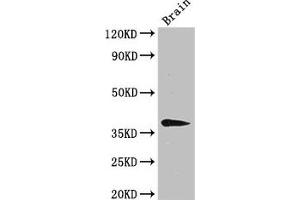 Western Blot Positive WB detected in: Mouse brain tissue All lanes: B4GALT7 antibody at 3 μg/mL Secondary Goat polyclonal to rabbit IgG at 1/50000 dilution Predicted band size: 38 kDa Observed band size: 38 kDa (B4GALT7 Antikörper  (AA 52-327))