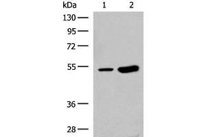 Western blot analysis of Human left thymus tissue and Mouse kidney tissue lysates using ZBTB43 Polyclonal Antibody at dilution of 1:250 (ZBTB43 Antikörper)