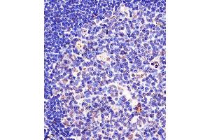 (ABIN657676 and ABIN2846668) staining SF3B1 in human tonsil tissue sections by Immunohistochemistry (IHC-P - paraformaldehyde-fixed, paraffin-embedded sections). (SF3B1 Antikörper  (N-Term))