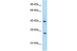 Image no. 1 for anti-Axin Interactor, Dorsalization Associated (AIDA) (AA 48-97) antibody (ABIN6748006) (AIDA Antikörper  (AA 48-97))