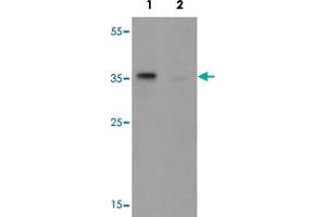 Western blot analysis of TSPY1 in A-20 cell lysate with TSPY1 polyclonal antibody  at 1 ug/mL in (1) the absence and (2) the presence of blocking peptide. (TSPY1 Antikörper  (C-Term))
