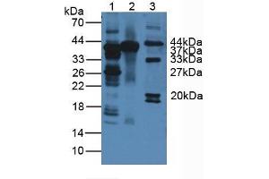 Western blot analysis of (1) Human Liver Tissue, (2) Mouse Liver Tissue and (3) Mouse Heart Tissue. (ARG Antikörper  (AA 1-322))