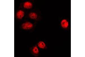 Immunofluorescent analysis of MGCRACGAP staining in K562 cells. (RACGAP1 Antikörper  (N-Term))