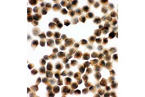 Anti-SNAP23 antibody,ICC ICC: K562 Cell