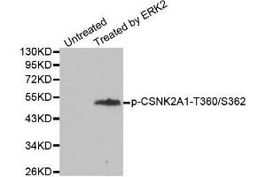 Western blot analysis of extracts from 293 cells, using Phospho-CSNK2A1-T360/S362 antibody. (CSNK2A1/CK II alpha Antikörper  (pSer362, pThr360))
