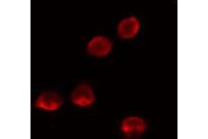 ABIN6274136 staining LOVO cells by IF/ICC. (MED26 Antikörper  (N-Term))