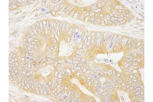 Immunohistochemistry (IHC) image for anti-Growth Factor Receptor-Bound Protein 10 (GRB10) (AA 100-150) antibody (ABIN7448583) (GRB10 Antikörper  (AA 100-150))