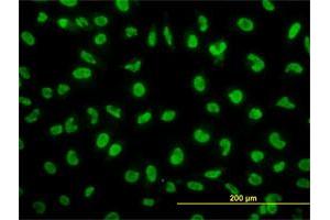 Immunofluorescence of monoclonal antibody to SNAI2 on HeLa cell. (SLUG Antikörper  (AA 97-169))