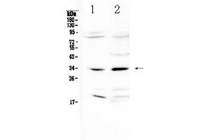 Western blot analysis of MyD88 using anti-MyD88 antibody . (MYD88 Antikörper  (AA 14-263))