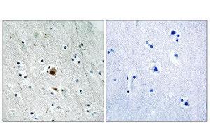 Immunohistochemistry (IHC) image for anti-Mitogen-Activated Protein Kinase-Activated Protein Kinase 2 (MAPKAPK2) (pSer272) antibody (ABIN1847788) (MAPKAP Kinase 2 Antikörper  (pSer272))
