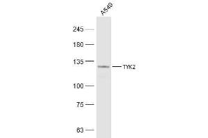 A549 lysates probed with TYK2 Polyclonal Antibody, Unconjugated  at 1:500 dilution and 4˚C overnight incubation. (TYK2 Antikörper  (AA 401-500))