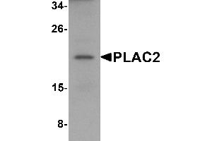 Western Blotting (WB) image for anti-Tissue Differentiation-Inducing Non-Protein Coding RNA (TINCR) (Middle Region) antibody (ABIN1031042) (PLAC2 Antikörper  (Middle Region))