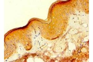 Immunohistochemistry of paraffin-embedded human skin tissue using ABIN7154836 at dilution of 1:100