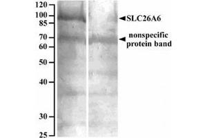 AP32082PU-N SLC26A6 Antibody staining of Human renal cortical brush-border membrane lysate at 10 µg/ml (90 µg protein denatured at 37°C for 30min) with (B) and without (A) blocking with the immunizing peptide. (SLC26A6 Antikörper  (Internal Region))