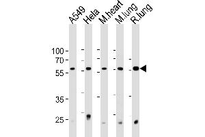 PRS4 Antibody (C-term) (ABIN1881692 and ABIN2843376) western blot analysis in A549,Hela cell line and mouse heart and lung,rat lung tissue lysates (35 μg/lane). (PSMC1 Antikörper  (C-Term))