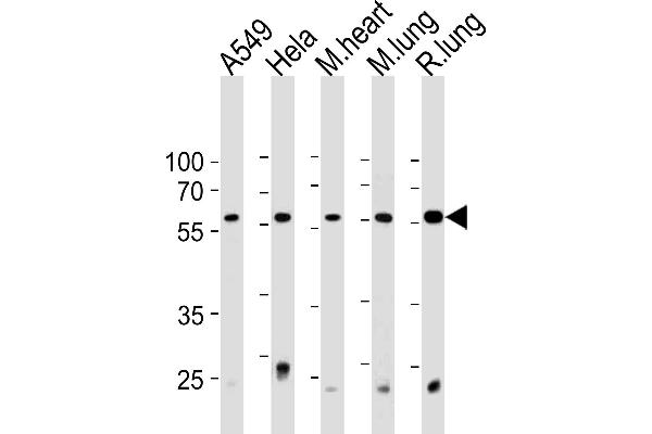 PSMC1 Antikörper  (C-Term)
