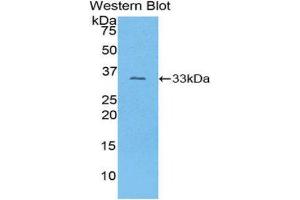 Western Blotting (WB) image for anti-Collagen, Type I, alpha 1 (COL1A1) (AA 1225-1453) antibody (ABIN1077674) (COL1A1 Antikörper  (AA 1225-1453))