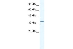 WB Suggested Anti-ZFP589 Antibody Titration:  1. (ZFP589 (Middle Region) Antikörper)