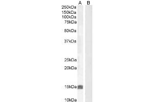 Western Blotting (WB) image for anti-Insulin-Like Growth Factor 1 (IGF1) (Internal Region) antibody (ABIN571240)