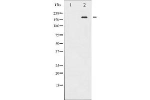 Western blot analysis of EGFR phosphorylation expression in EGF treated A431 whole cell lysates,The lane on the left is treated with the antigen-specific peptide.