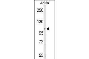 Western blot analysis of mouse anti-Sema5a Pab in A2058 cell line lysates (35ug/lane).