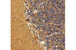 IHC analysis of DNM3 using anti-DNM3 antibody (ABIN7601163). (Dynamin 3 Antikörper  (AA 295-712))