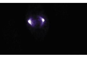 Immunofluorescence staining of human endothelial cells. (Aurora A Antikörper  (AA 8-116))