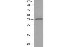 Western Blotting (WB) image for Nuclear Factor of kappa Light Polypeptide Gene Enhancer in B-Cells Inhibitor, delta (NFKBID) (AA 1-313) protein (His tag) (ABIN7124207) (NFKBID Protein (AA 1-313) (His tag))