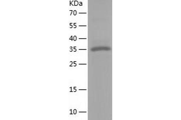 NFKBID Protein (AA 1-313) (His tag)