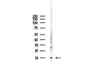 anti-Mitochondrial Ribosomal Protein L49 (MRPL49) (Internal Region) antibody