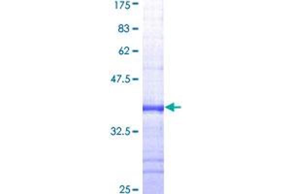 ABCB1 Protein (AA 620-709) (GST tag)