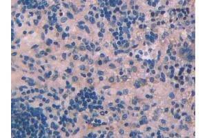 DAB staining on IHC-P; Samples: Rat Spleen Tissue (PLA2G2D Antikörper  (AA 20-134))