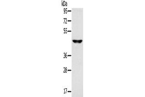 Western Blotting (WB) image for anti-Monocarboxylate Transporter 3 (MCT3) antibody (ABIN2433812) (MCT3 Antikörper)