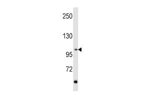 Western blot analysis of hRET-G28 (ABIN392040 and ABIN2841808) in MCF7 cell line lysates (35 μg/lane).