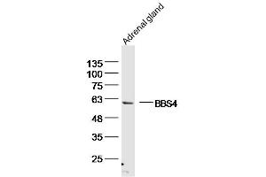 Mouse adrenal gland lysates probed with BBS4 Polyclonal Antibody, unconjugated  at 1:300 overnight at 4°C followed by a conjugated secondary antibody for 60 minutes at 37°C. (BBS4 Antikörper  (AA 431-519))