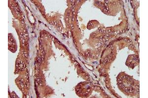 IHC image of ABIN7158882 diluted at 1:400 and staining in paraffin-embedded human prostate tissue performed on a Leica BondTM system. (MIF Antikörper  (AA 2-115))