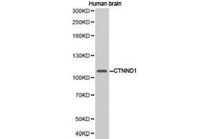 Western Blotting (WB) image for anti-Catenin (Cadherin-Associated Protein), delta 1 (CTNND1) antibody (ABIN1872087)